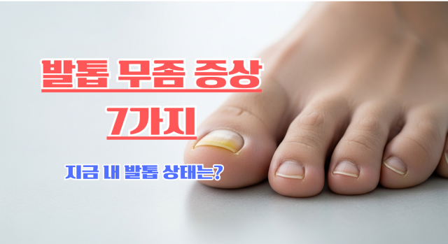 발톱 무좀 증상 7가지 자가 확인 가이드