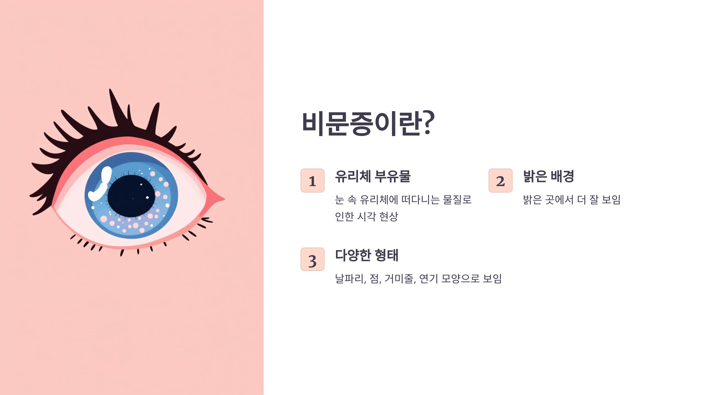 비문증과 관련된 사진입니다.