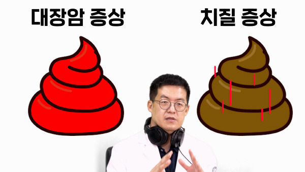 대장암 초기증상