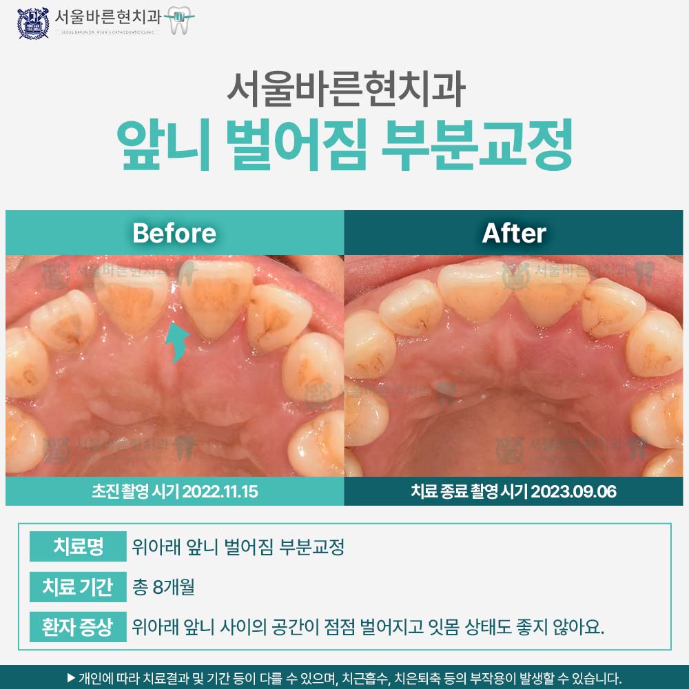 해운대교정치과