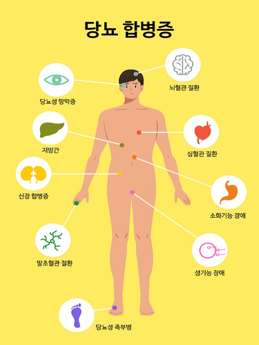 당뇨병 초기증상