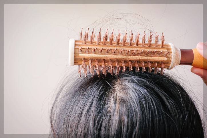 로게인폼-가격-로게인폼-부작용