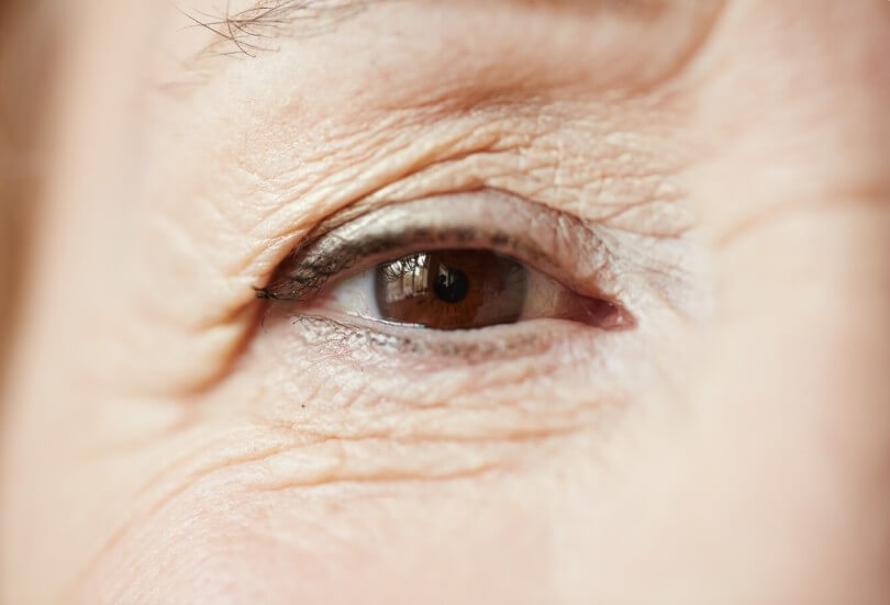 할머니의 한쪽 눈