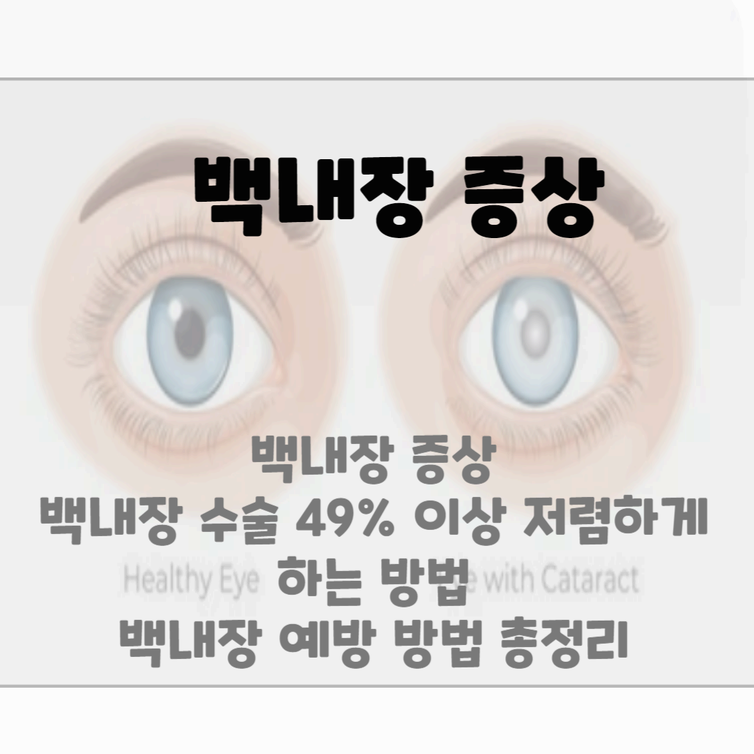 백내장 증상, 예방 방법 총정리 블로그 썸네일 사진
