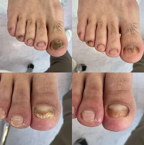 레푸스 춘천후평점