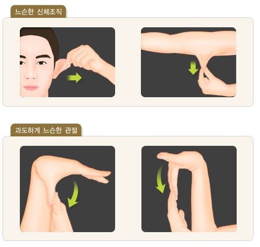 콜라겐 결핍증