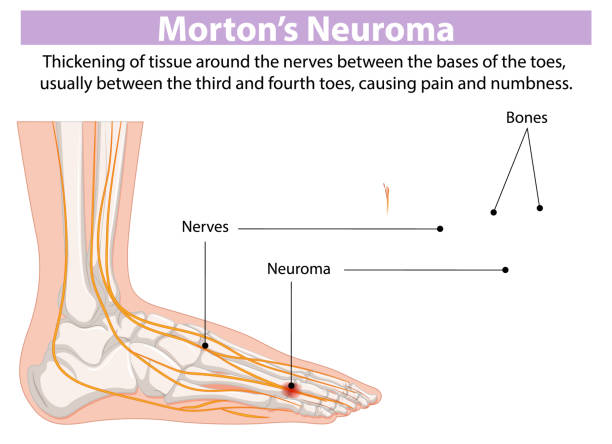 중장년 필수! 건강한 발 관리템 추천