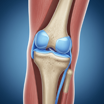 퇴행성관절염 증상 총정리1