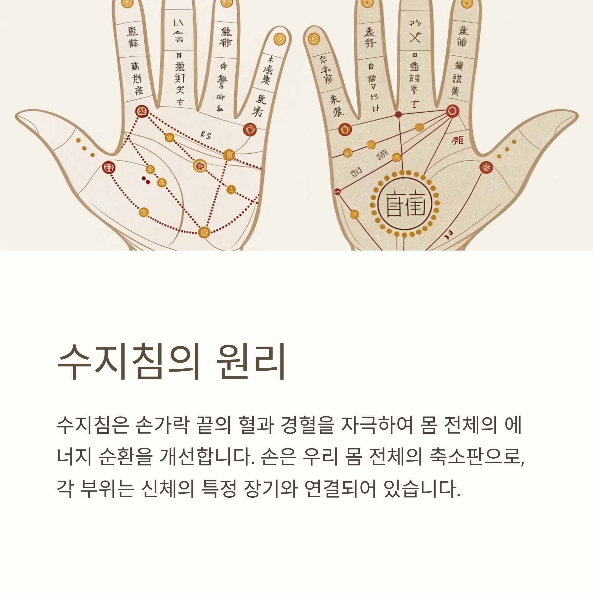 손발 저림에 수지침