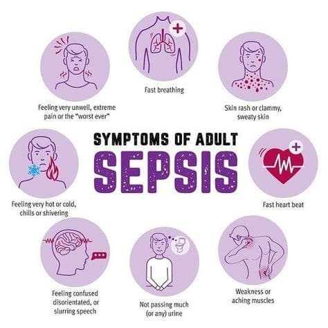 패혈증(Sepsis) 간호 중재와 조기 사정 방법