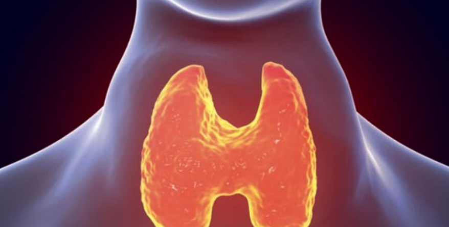 갑상선기능항진증의 정의