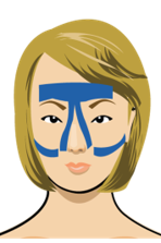 비염 및 축농증