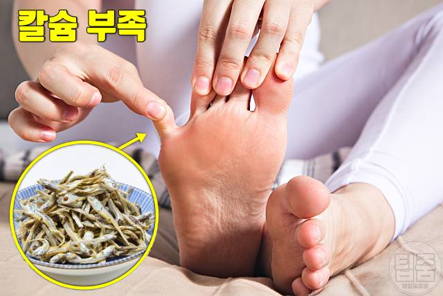 밥 잘먹는 사람 칼슘부족증상 다리 쥐