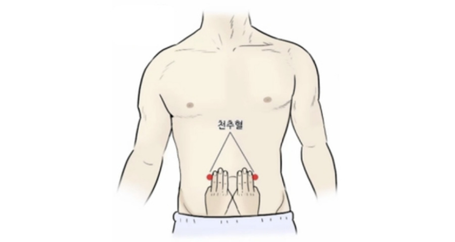 인체의 365혈 중에 배쪽에 위치를 한 천추혈을 나타내주는 그림으로 배꼽의 양쪽 옆으로 손가락 3개 쯤 옆에 위치를 한다는 것을 보여준다.