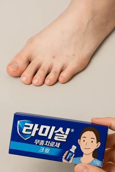 라미실 무좀약 구매 후 실제 후기