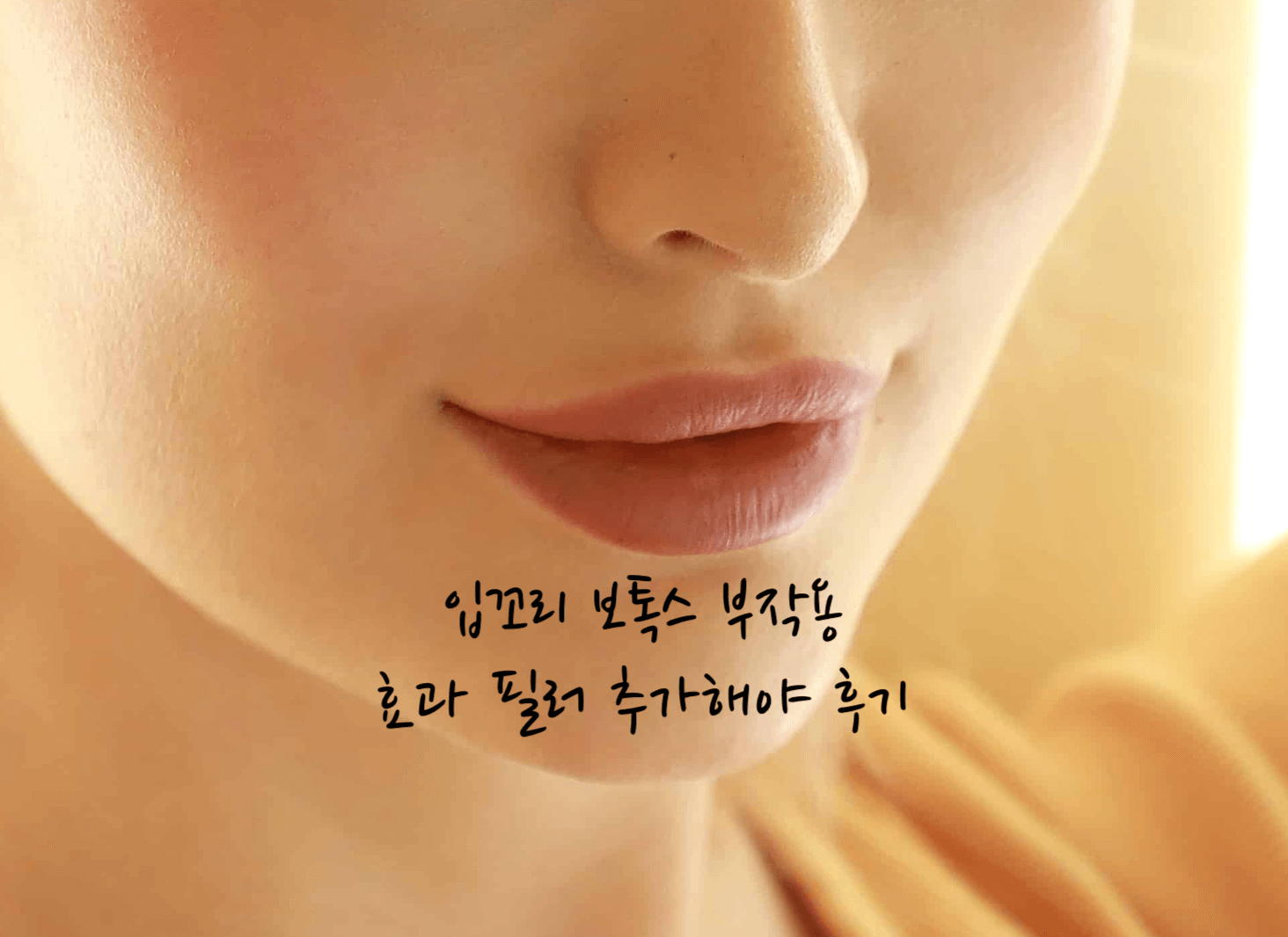 입꼬리 보톡스 부작용