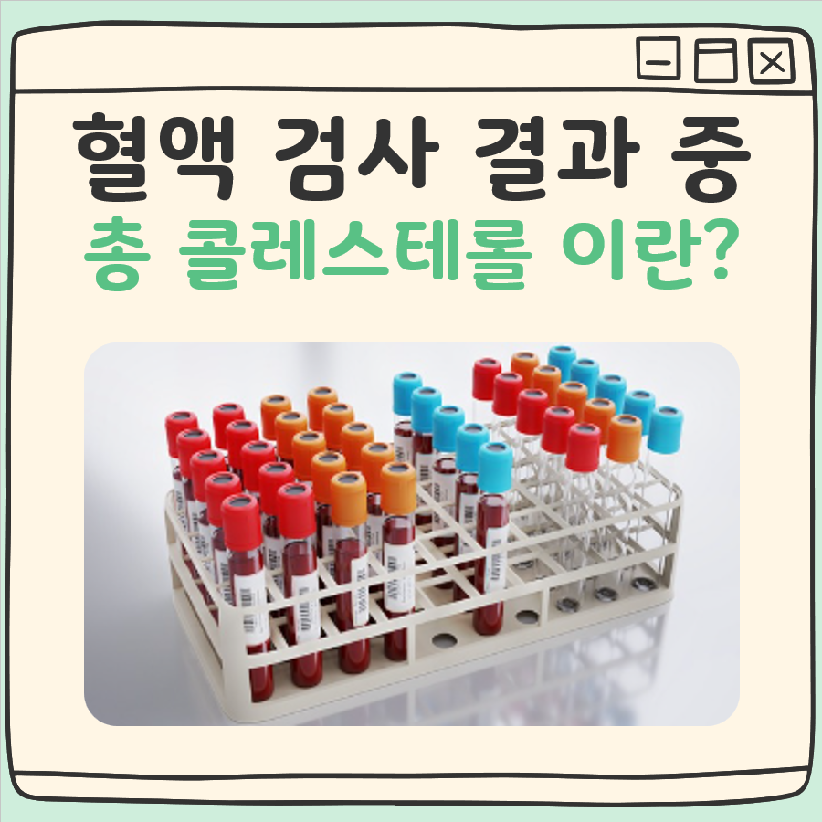 총 콜레스테롤 이란 대표 이미지