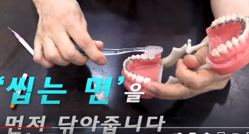 양치질-방법