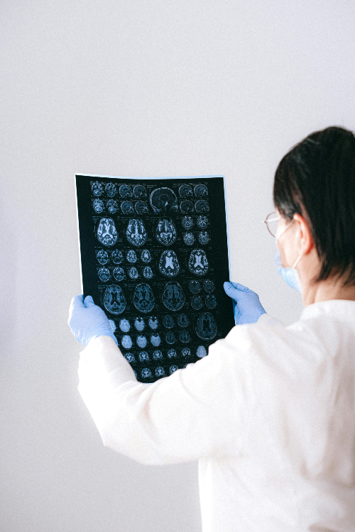 치매와 가을 우울증 연관성을 확인하기 위해 뇌 MRI 필름을 검토하는 의사