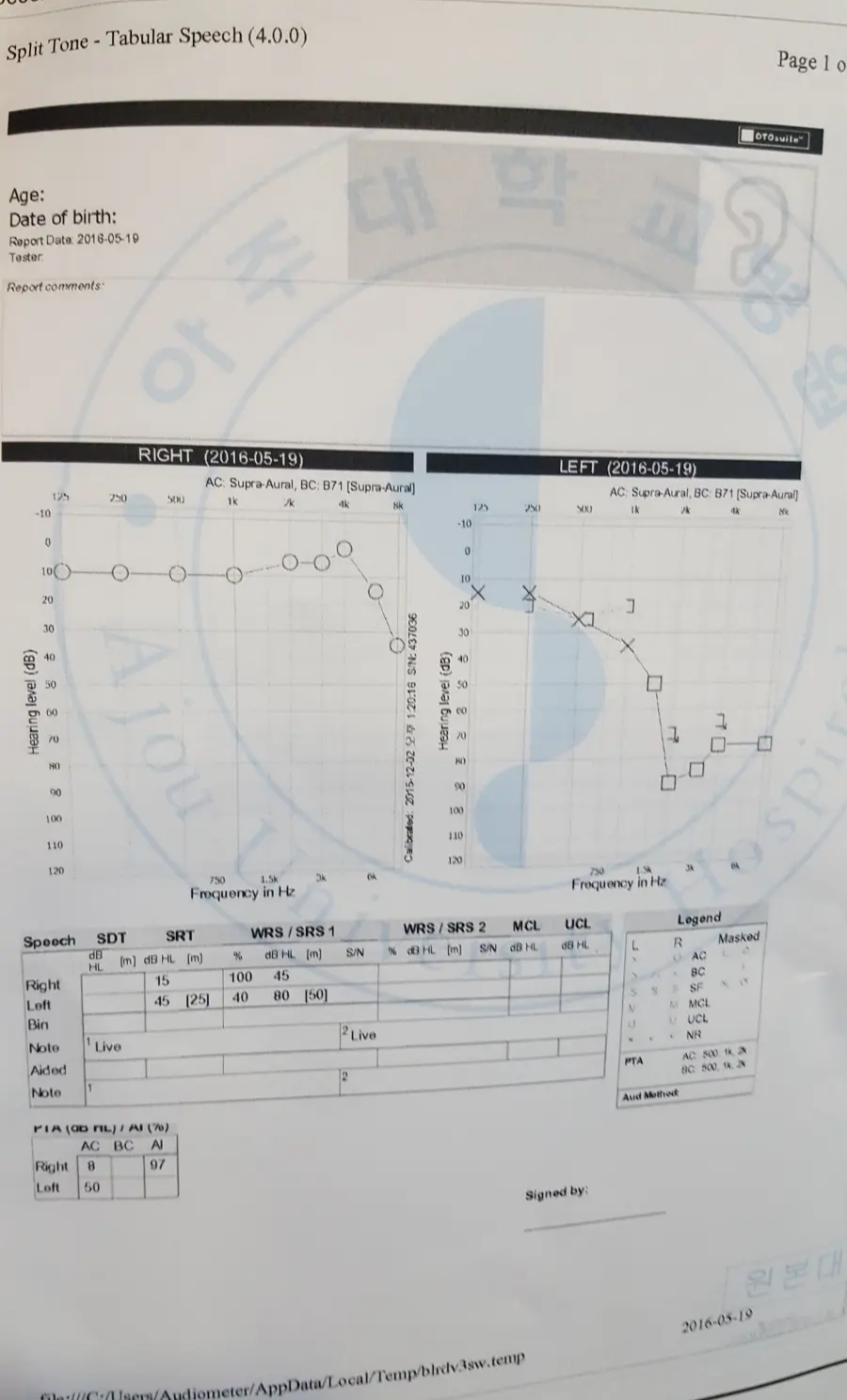 2016년 5월 19일 아주대학교 병원에서 청력검사 받은 결과지