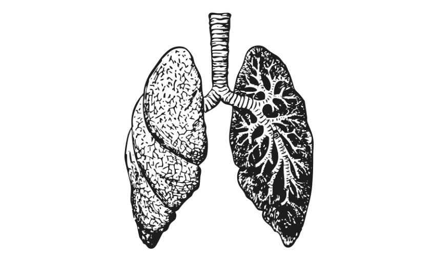 폐섬유증이란 무엇인가요? 원인부터 초기증상·자가진단까지 총정리!