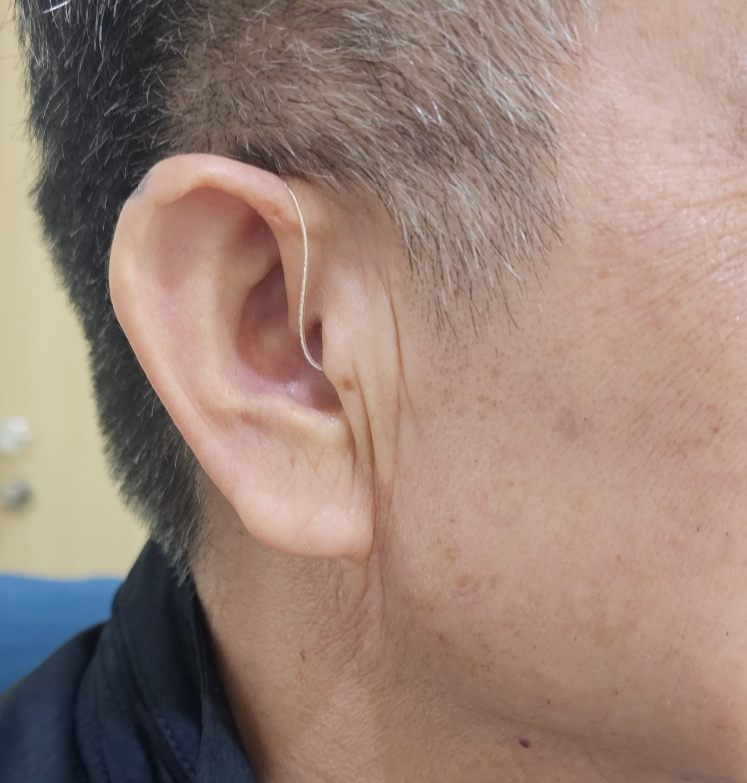 귀걸이형 보청기 착용사진입니다
