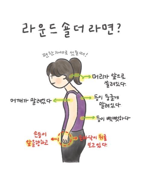 라운드숄더 첨부사진