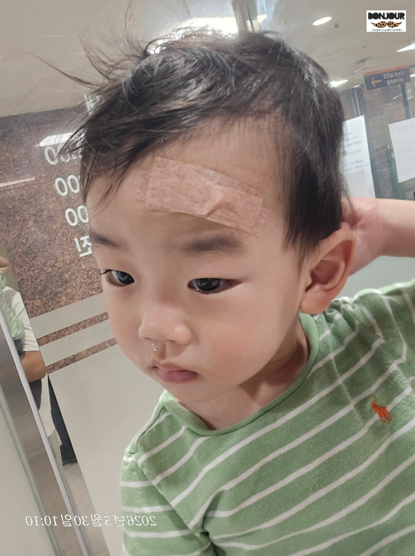 성형외과 봉합 직후 반창고