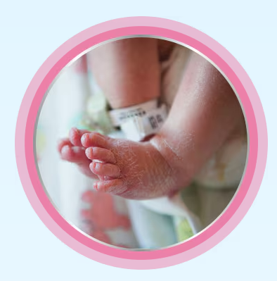 신생아 피부질환