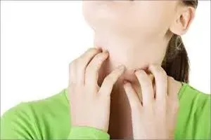 가려움