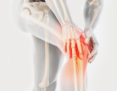 퇴행성 관절염 증상