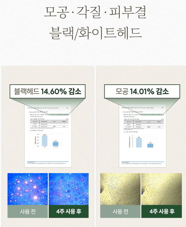 천비누솝 정안고