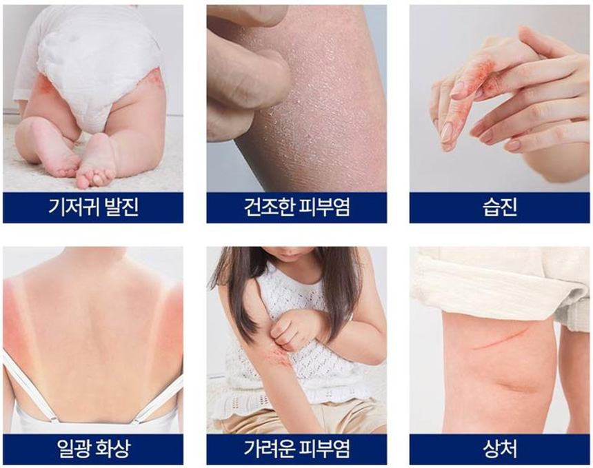 비판텐-연고-사용-시-주의사항