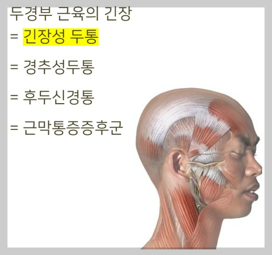 지끈지끈 머리 두통 : 원인과 해결 방법