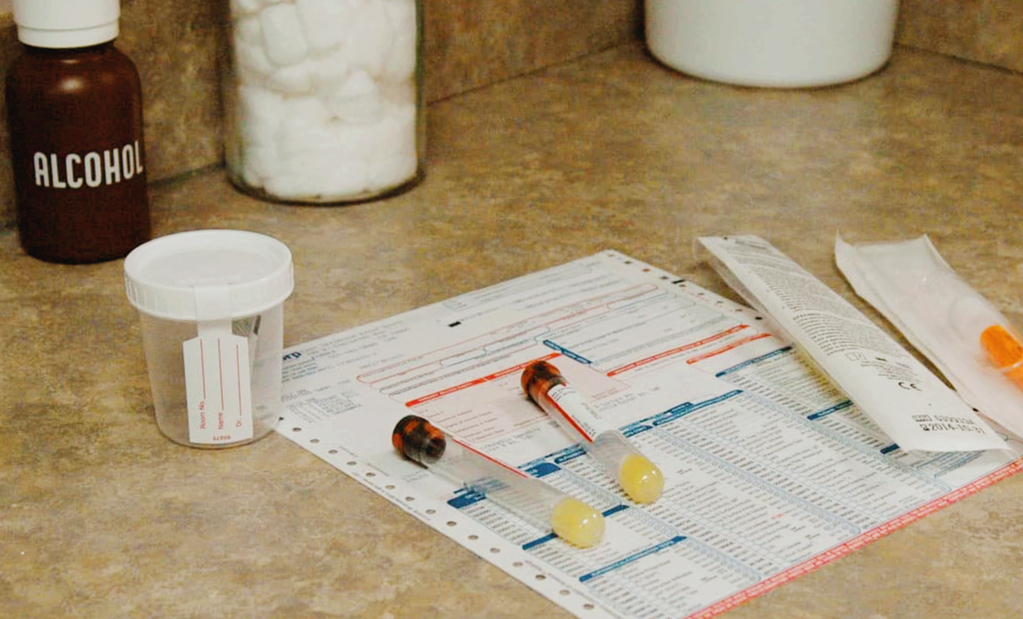 용혈(Hemolysis)이 검사 결과에 미치는 영향 ❘ 혈액 검사 오류의 주범 : 임상병리학적 의미와 방지법