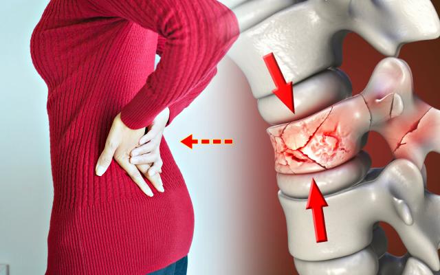 골다공증에 좋은 음식