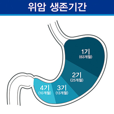 4기 위암의 생존율