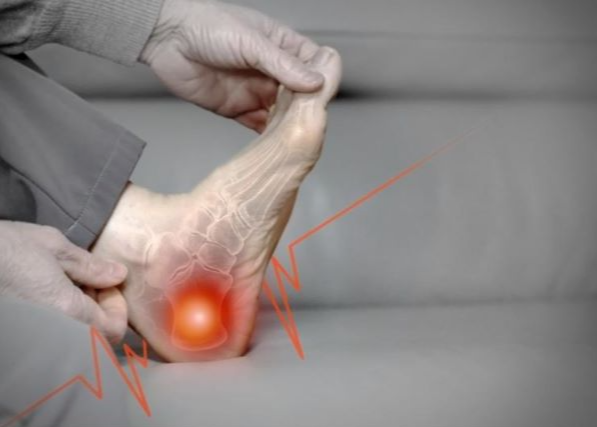 족저근막염 증상 치료바법 실제 성공 사례