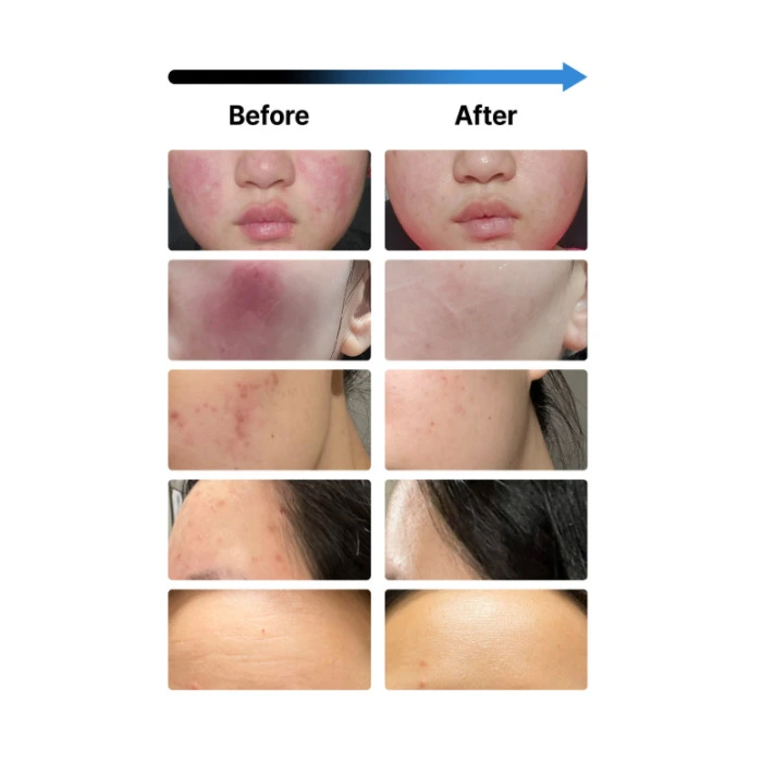 글로우엠 부스터 소닉 내돈내산 후기 부작용 효능 사용법 가격