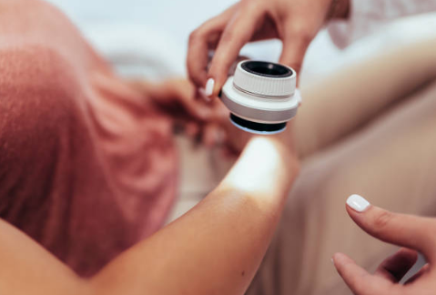 쥐젖 제거방법, 쥐젖이 생기는 이유, 제거 연고 총정리 (2024ver)