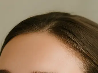 니코틴산 아미드 효능