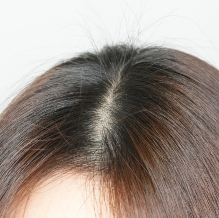 두피 건강 샴푸
