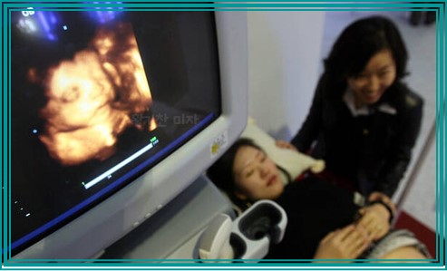 태아 성별알수있는시기