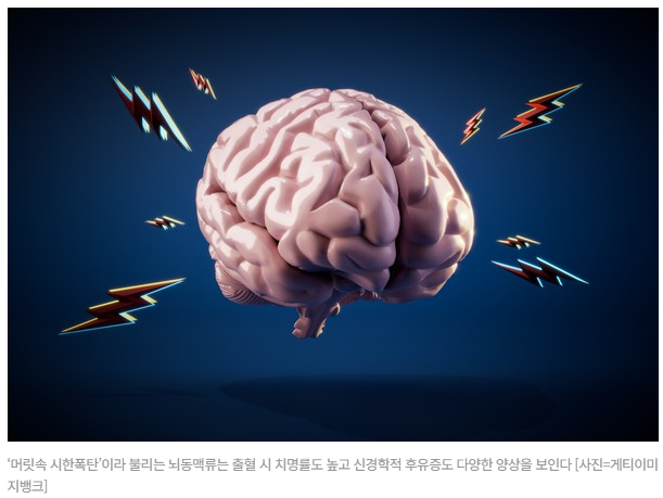 대뇌동맥류의 원인
