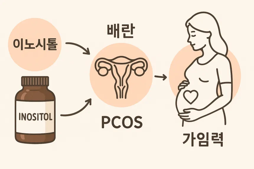 이노시톨 임신