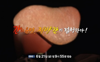 간의운명지방간이결정한다