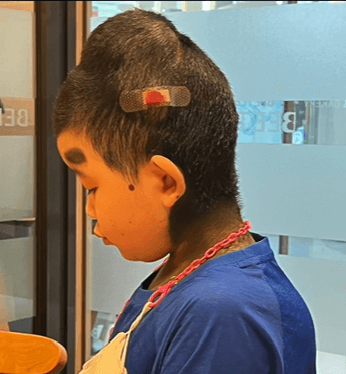 살이 불에 타는것 같아요3