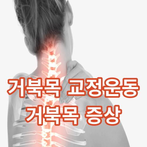 거북목-교정운동-거북목-증상-건강