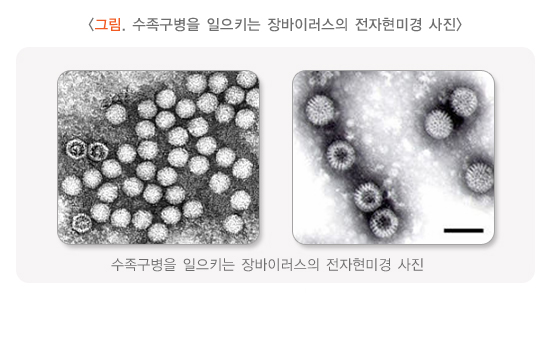 수족구병 증상 및 예방법