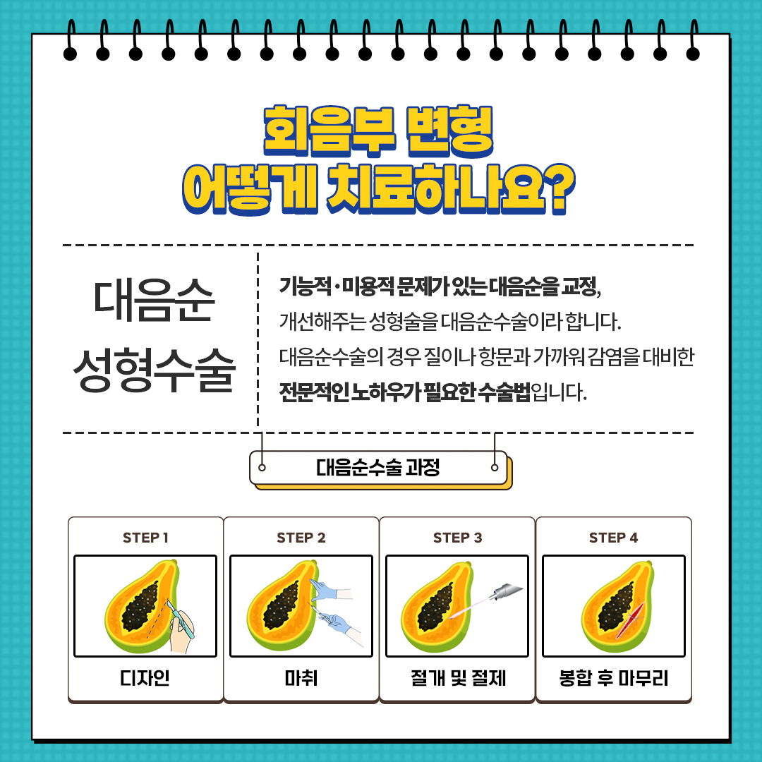 신사동 산부인과 회음부 상처 염증 자꾸 재발되는데 왜 그런건가요?